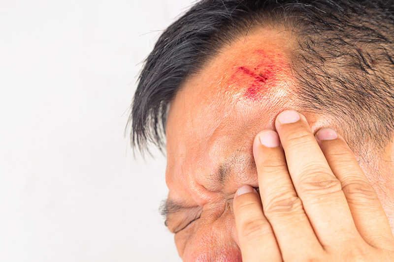 Head Injury Treatment in Vapi