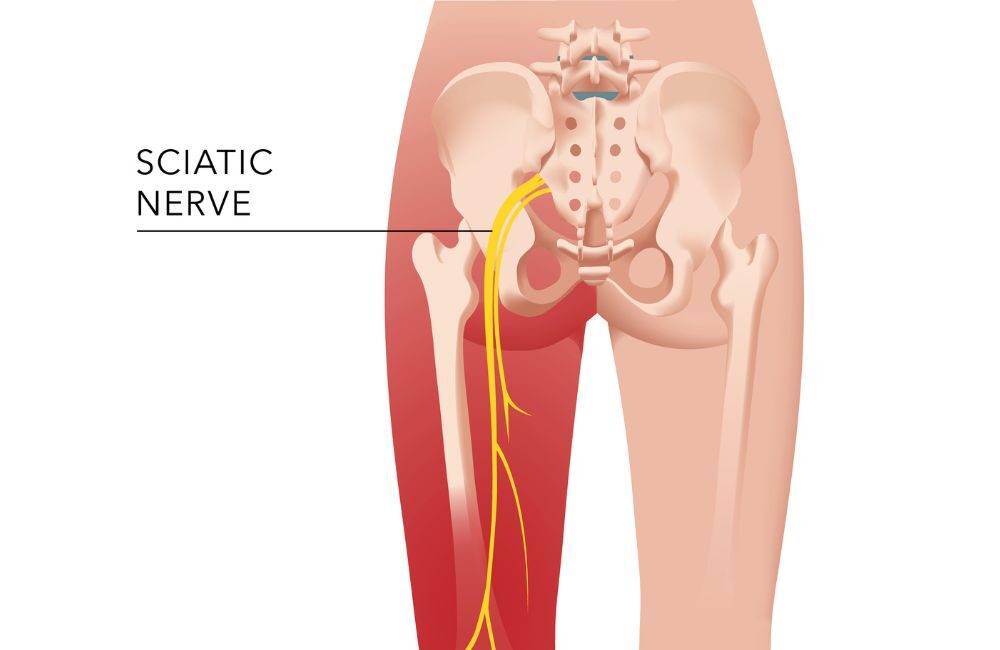 Sciatica Treatment in Vapi